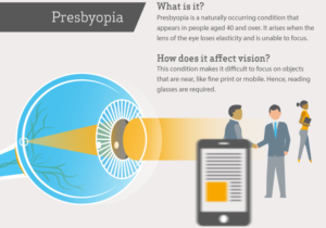 presbyopia